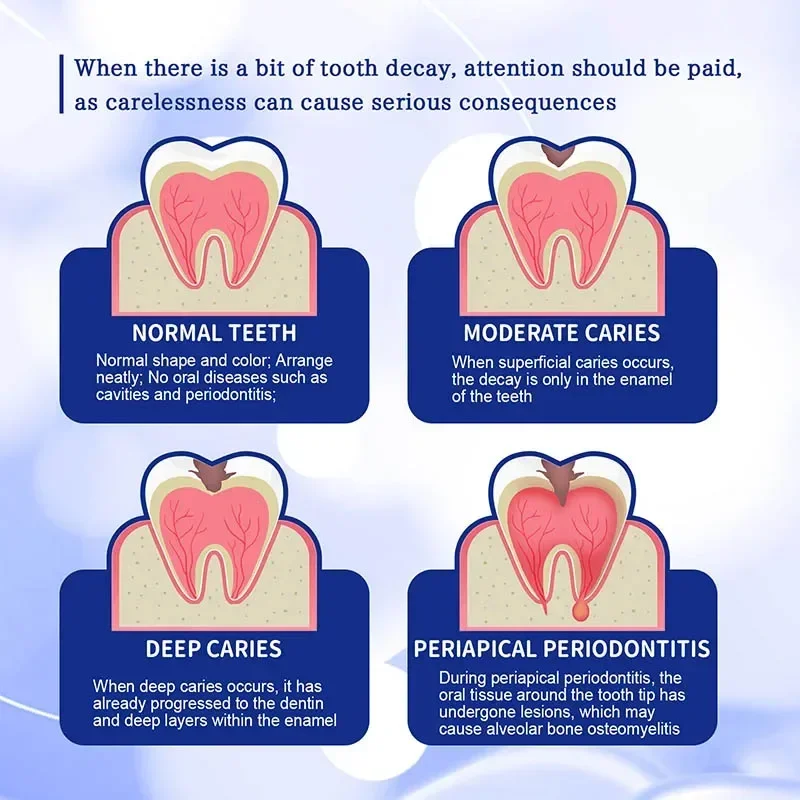 Reparar todas as cáries dentárias, cavidades dentárias, proteger os dentes, reparar branqueamento, laboratório dental, cárie, dental