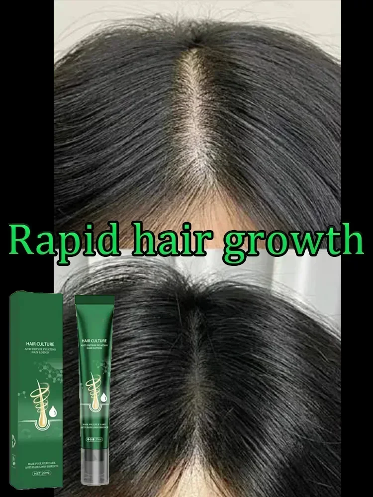 Fast Effective Hair Growth Oil Ginger Anti-Loss Hair Regrowth Serum Prevent Baldness Scalp Treatments Alopecia Hair Health Care