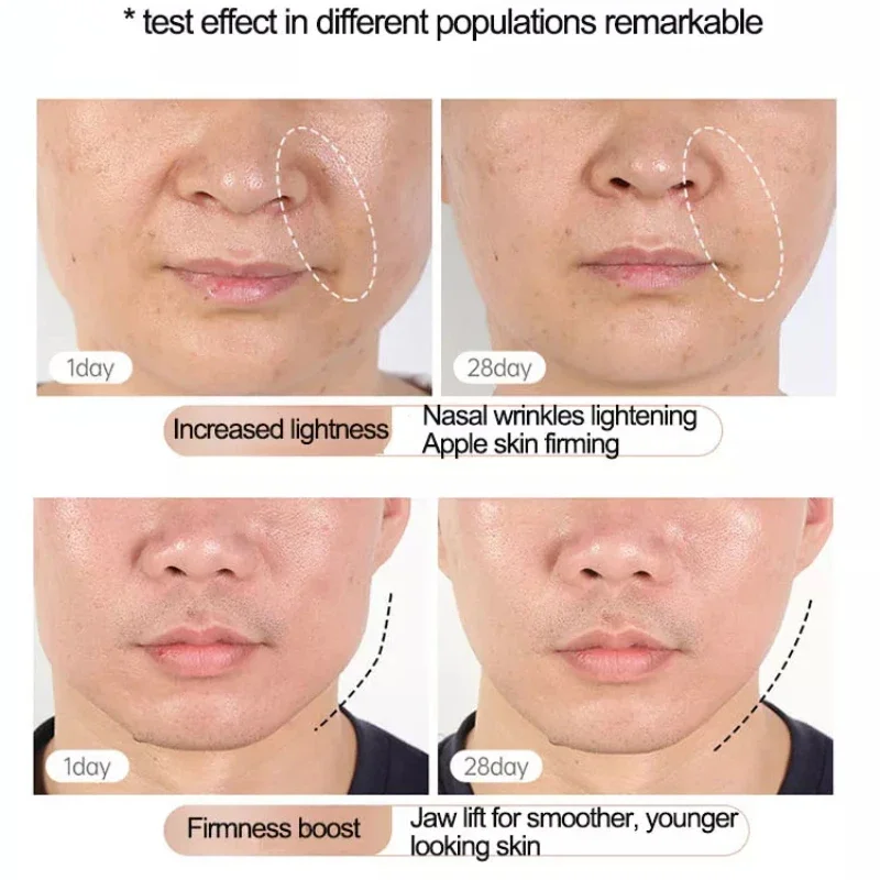 Anti aging/firming/rejuvenating/anti wrinkle/fat elimination/phototherapy/massage/skin droop Skin care product absorption