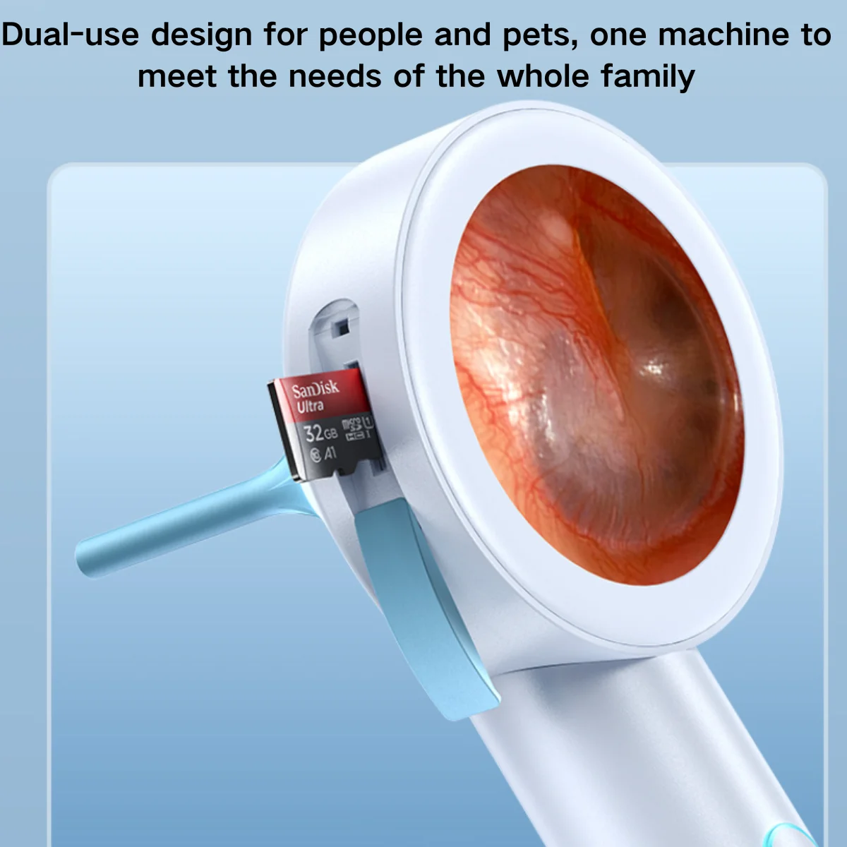 كاميرا أذن بشاشة 1.8 بوصة تشغيل/تسجيل فوري، منظار أذن للمنزل والحيوانات الأليفة للأطفال/الكلب/القطط، منظف أذن بصري عالي الدقة