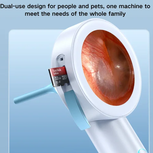 Imagen 1 del producto Cámara de oído con pantalla de 1,8 pulgadas, grabación instantánea, otoscopio para el hogar y mascotas para niños/adultos/perros/gatos, limpiador de oídos Visual HD