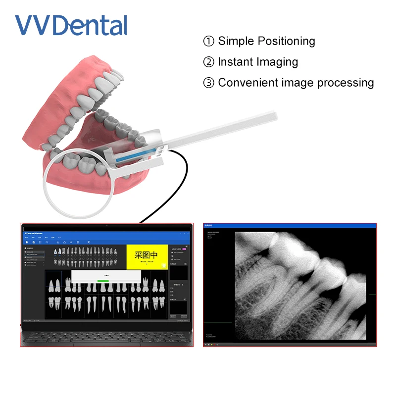 Dental X Ray Sensor 2 Year Warranty for Adult/Child Digital Sensor With Drive Software USB Cable RVG HDR Intraoral Image System
