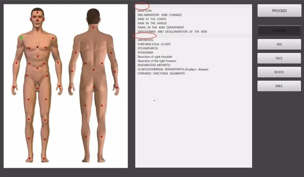 عرض ساخن لعام 2025 لعام 2022 أحدث إصدار من Tracker X3 عالي الدقة للجسم