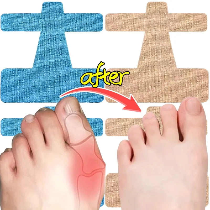 Toe Corrector Hallux Valgus Bunion Corrector Orthotic Tape Support Breathable Cotton Self Adhesive for Toe Alignment 10/30PCS