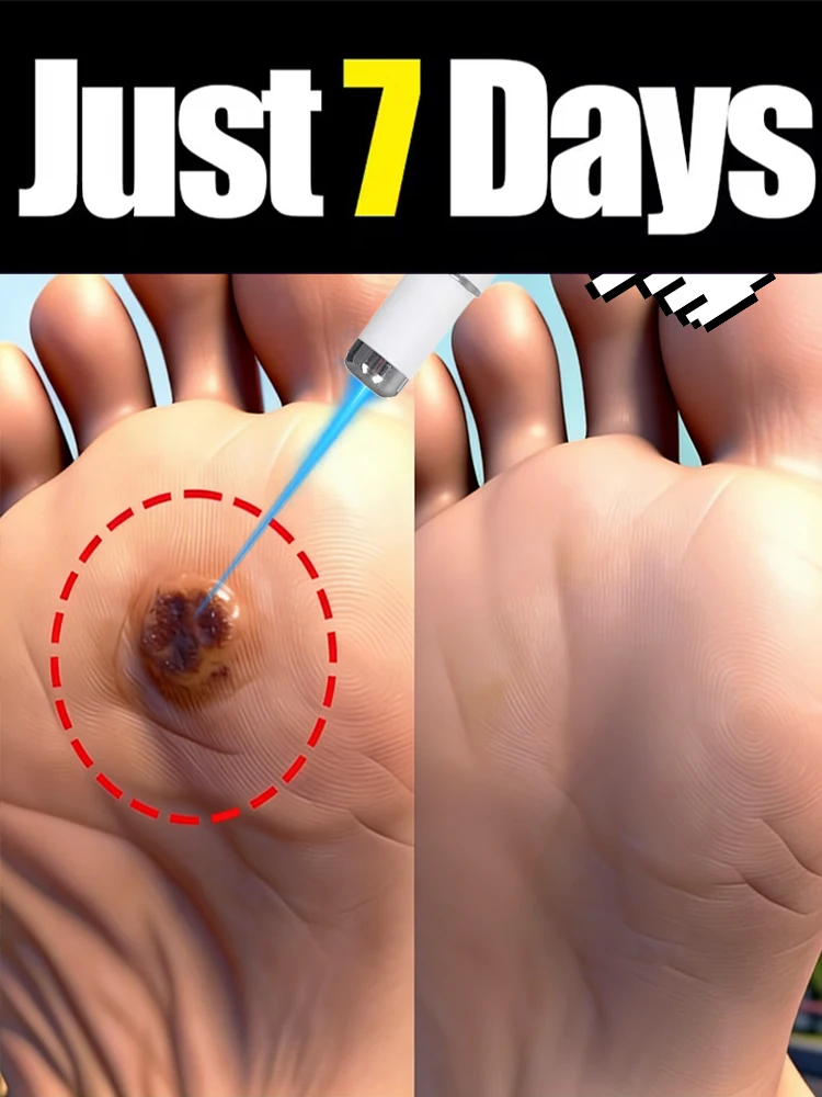 

Инструмент для чистки. Инструмент для ухода за ногами. Лампа с синим светом для лечения различных видов бородавок. Технологии меняют жизнь.