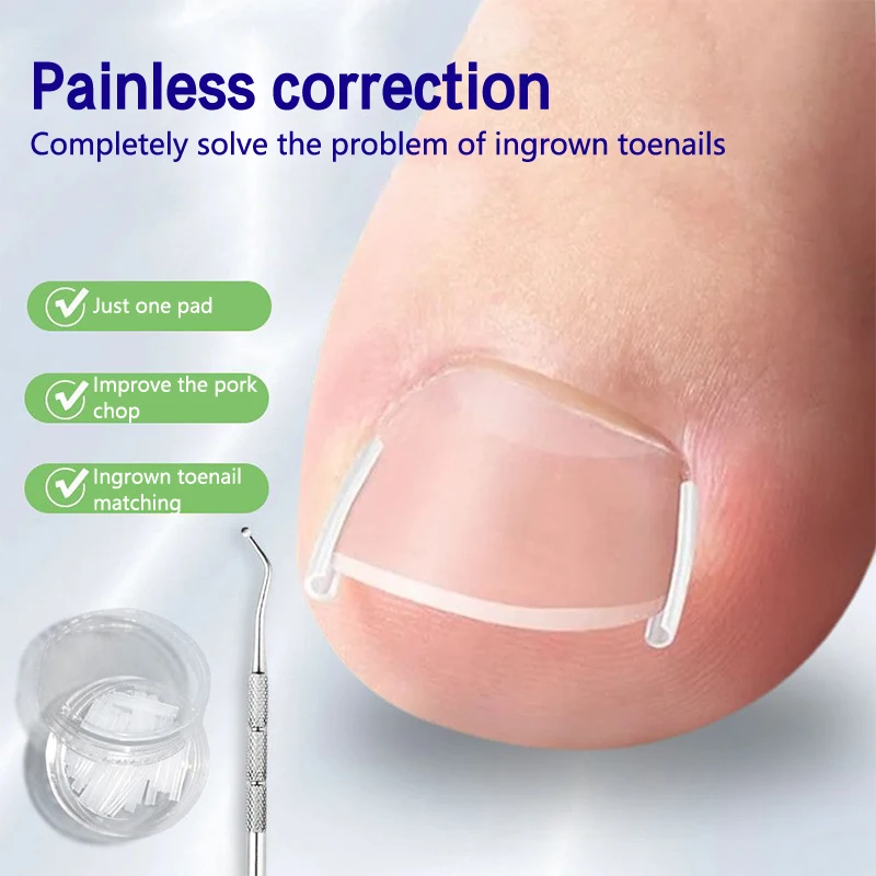 Toe Nail Care Hook Ingrown Double Ended Ingrown Toe Correction Lifter File Manicure Pedicure Toenails Clean Foot Care