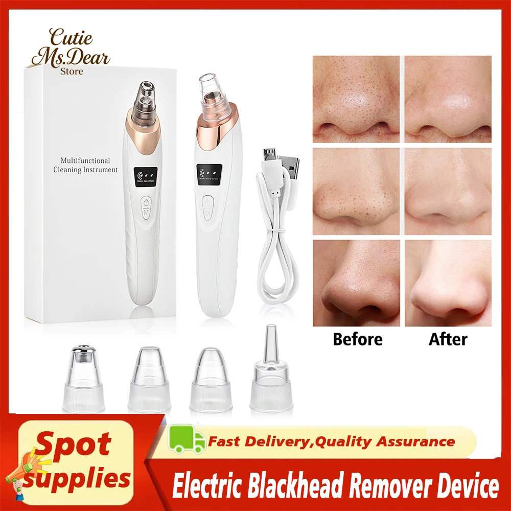 Elettrico per la rimozione dei punti neri del viso Testa nera Esfoliante per macchie Strumenti per la pulizia profonda del viso Detergente per brufoli neri Rimuovi le imperfezioni