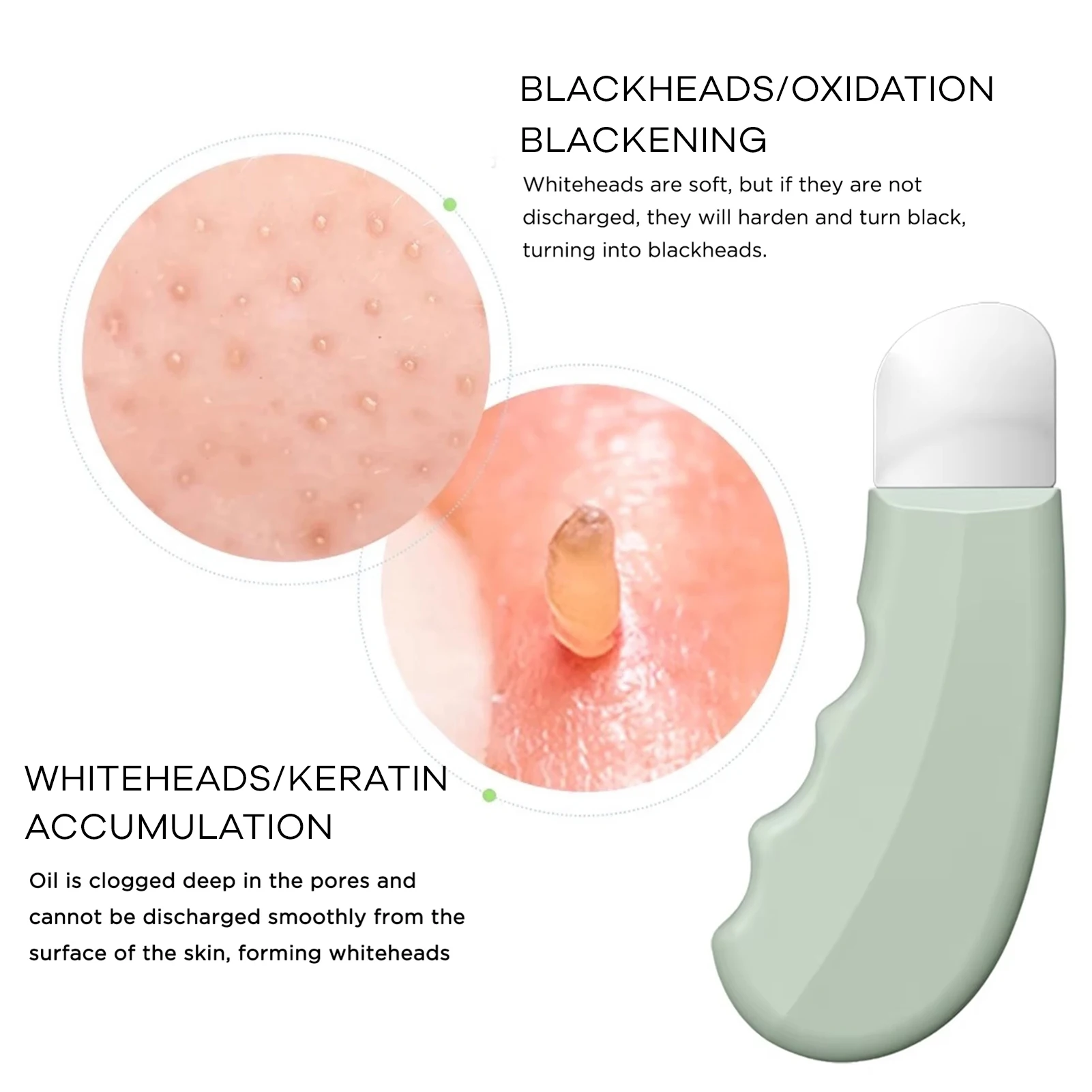 Strumento per la rimozione di punti neri ultrasottile - Detergente manuale per pori per naso e viso Estrattore di comedoni in acciaio inossidabile con impugnatura ergonomica