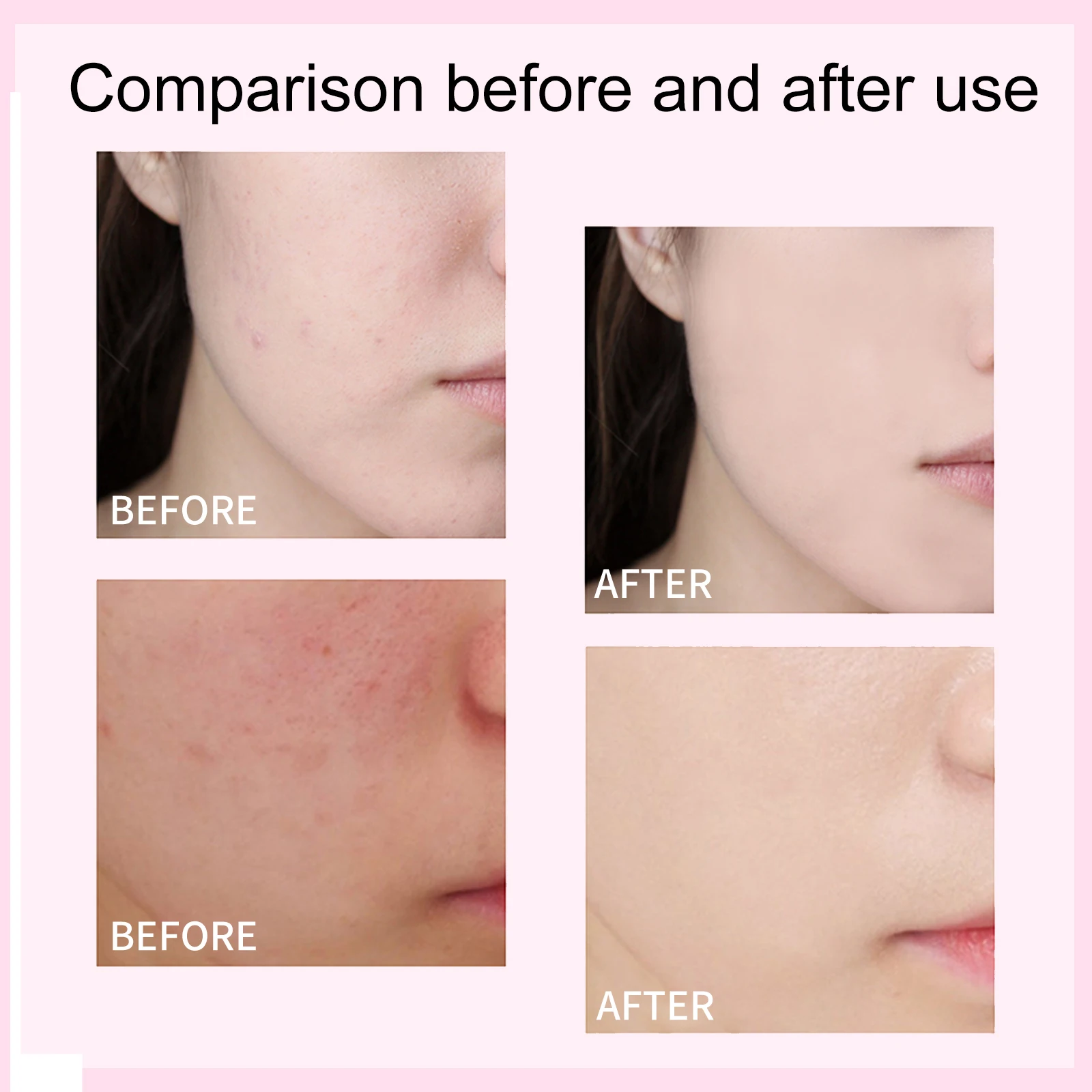 Thumbnail 3 - #10 Latest Face Primers Offers