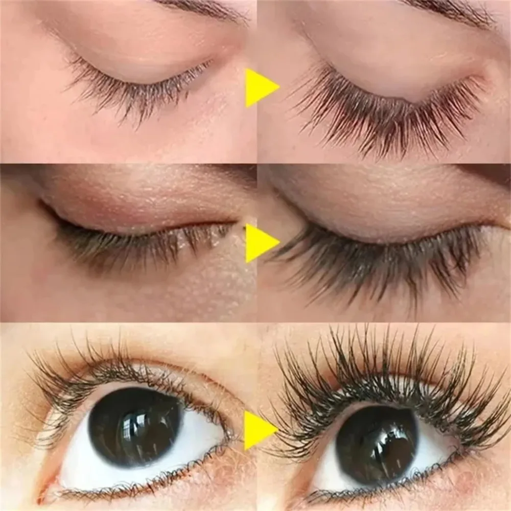 Eelhoe soro de crescimento rápido de cílios, suave e nutritivo, intensificador de cílios, mais cheio, mais grosso, curvador, tratamento de cílios, soro para os olhos