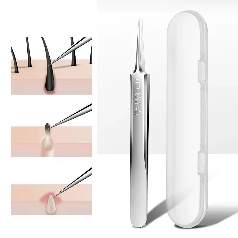 1 Pack Extra Fine No. 5 Cellular Acne Blackhead Tweezers - Facial Beauty Remove Acne Needle Tools for Skin Care