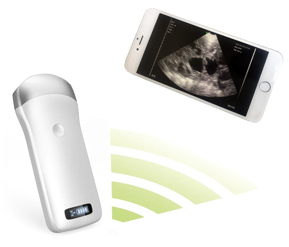 Portable Pregnancy Sonar Tester Handheld Pig WIFI Pocket Machine Goat Farm AI Tool Sheep Wireless Veterinary Ultrasound Scanner