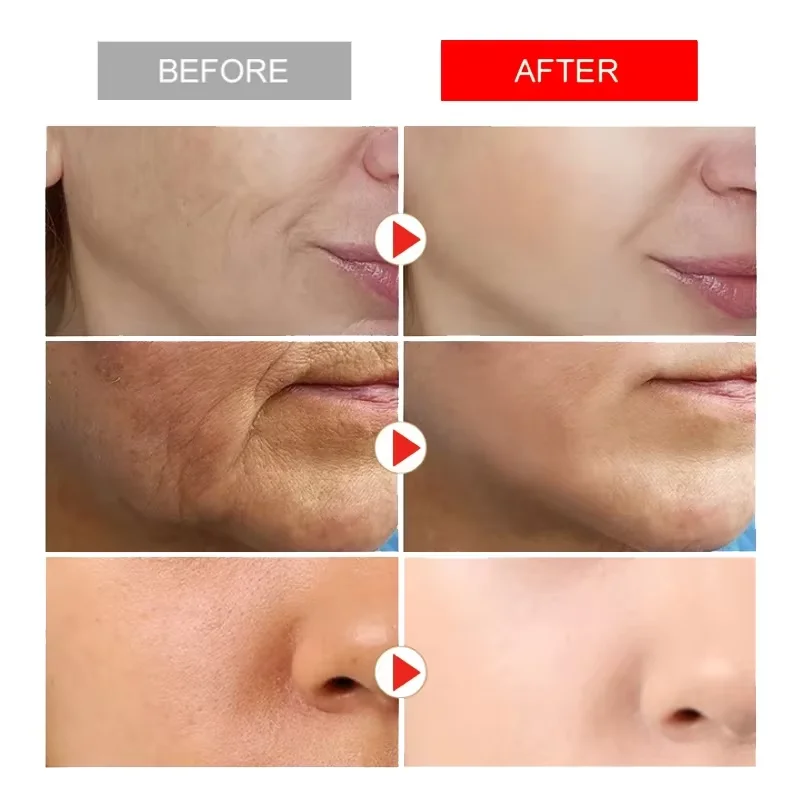 Eliminador instantáneo de arrugas, crema facial antienvejecimiento, reafirmante, se desvanece, líneas finas, blanqueamiento, hidratante, ilumina, reafirma el cuidado de la piel