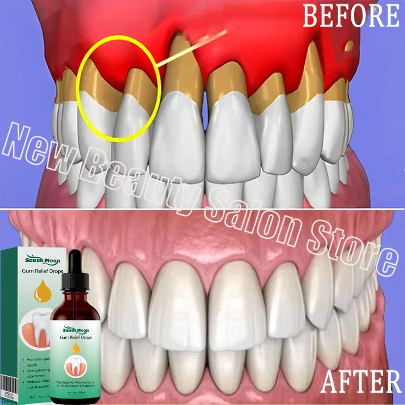 Reparar rapidamente goma soro cuidados dentes branquear remover amarelo reparação goma recrescimento placa manchas aliviar gengivas cárie dor de dente