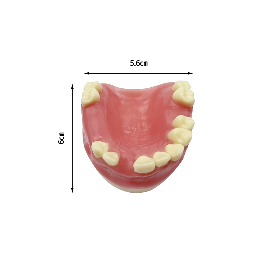 Wszczep Model nauczania brakujących zębów szczęki do szkolenia technika dentystycznego badającego narzędzie komunikacji lekarz-pacjent