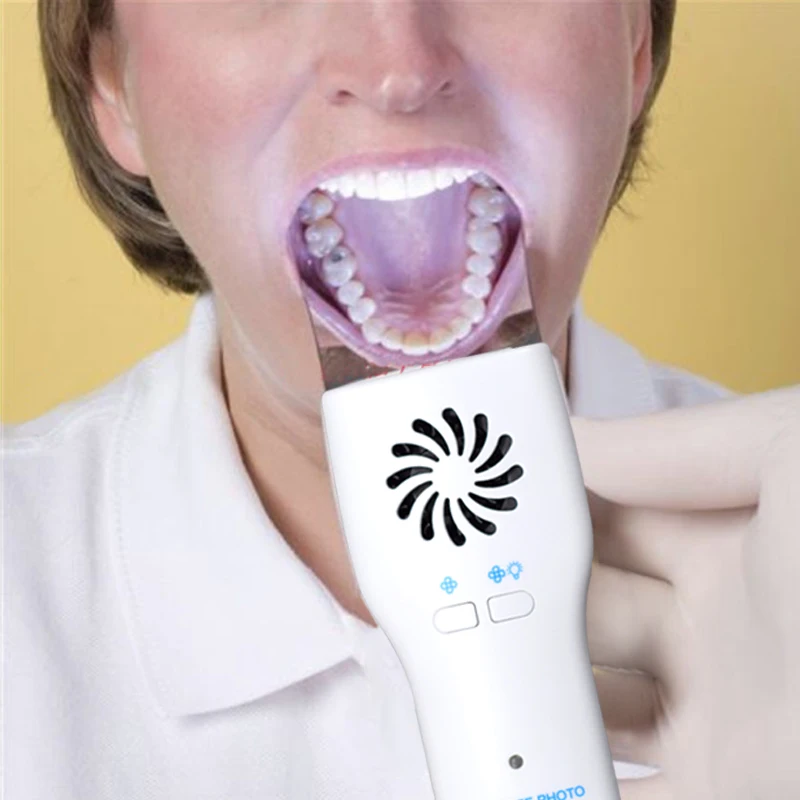 Oral Automatic Defogging Mirror Anti-fog Mirrors Orthodontic LED Photography Dental Instrument kits