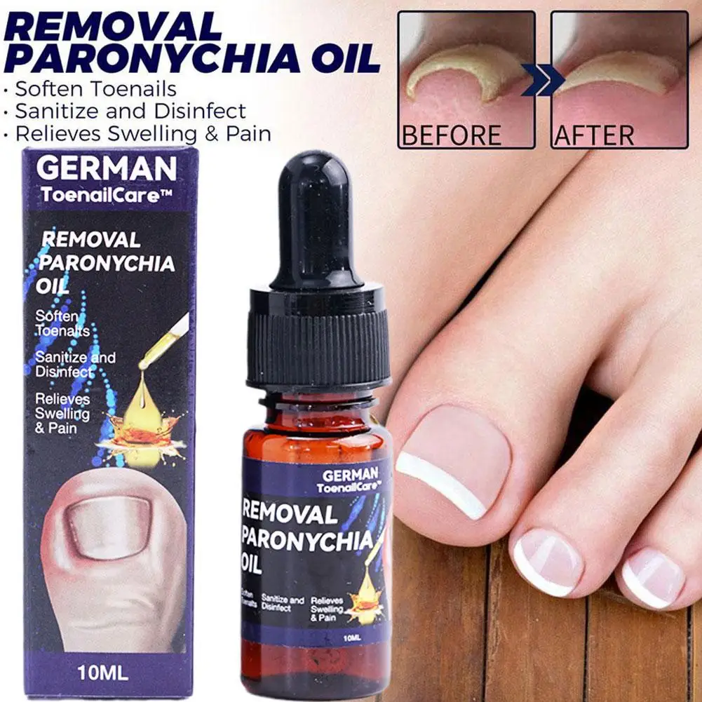 Toenailcare Removal Paronychia Oil Ingrown Toenail Treatment Best Nail Repair Solution Nail Renewal Liquid 10ml