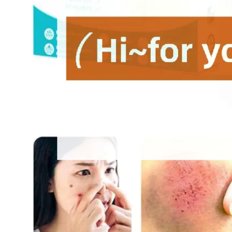 Hydrocolloid Roll For Wound Care Hydrocolloid Patch Bandages With Self-Adhesive Bed Sore Bandages Highly Absorbent For Burn
