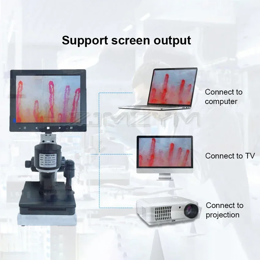 Digital Microscope Zoom Nailfold Capillary Microcirculation Detector Blood Microcirculation Analyzer with 7/8/9\