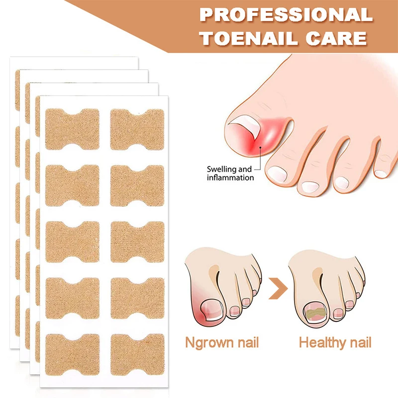 

60Pcs Ingrown Nail Correction Stickers Toenail Corrector Patches Paronychia Treatment Recover Corrector Pedicure Nail Care Tool