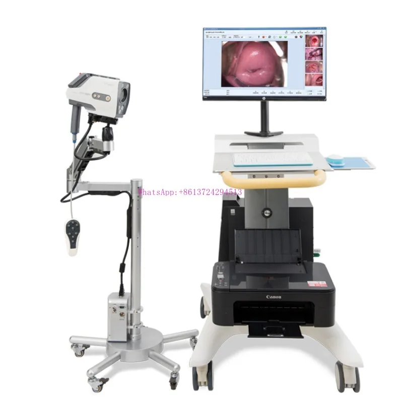 Full HD Vagina Image Digital Colposcope Workstation with Trolley