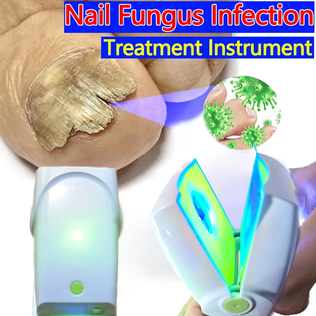 

Устройство для лазерной терапии грибка ногтей на ногах в домашних условиях, лечение онихомикоза 5 в 1 для здоровых ногтей, быстрый ремонт