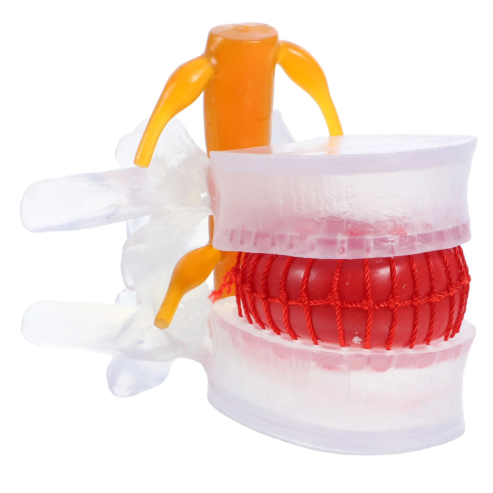 Lumbar Spine Model Disc Herniation for Demonstration Human Display Teaching Models Rubber Resin