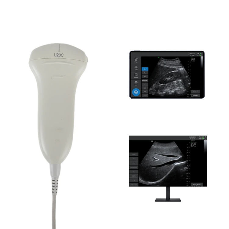 

Hot sell Micro Handheld Diagnosis Ultrasound ultrasound scanner hospital use