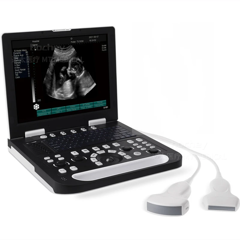 MT MEDICAL High Grade Medical Ultrasonic Scanning System CheapestVet Ultrasound Scanner for pet use