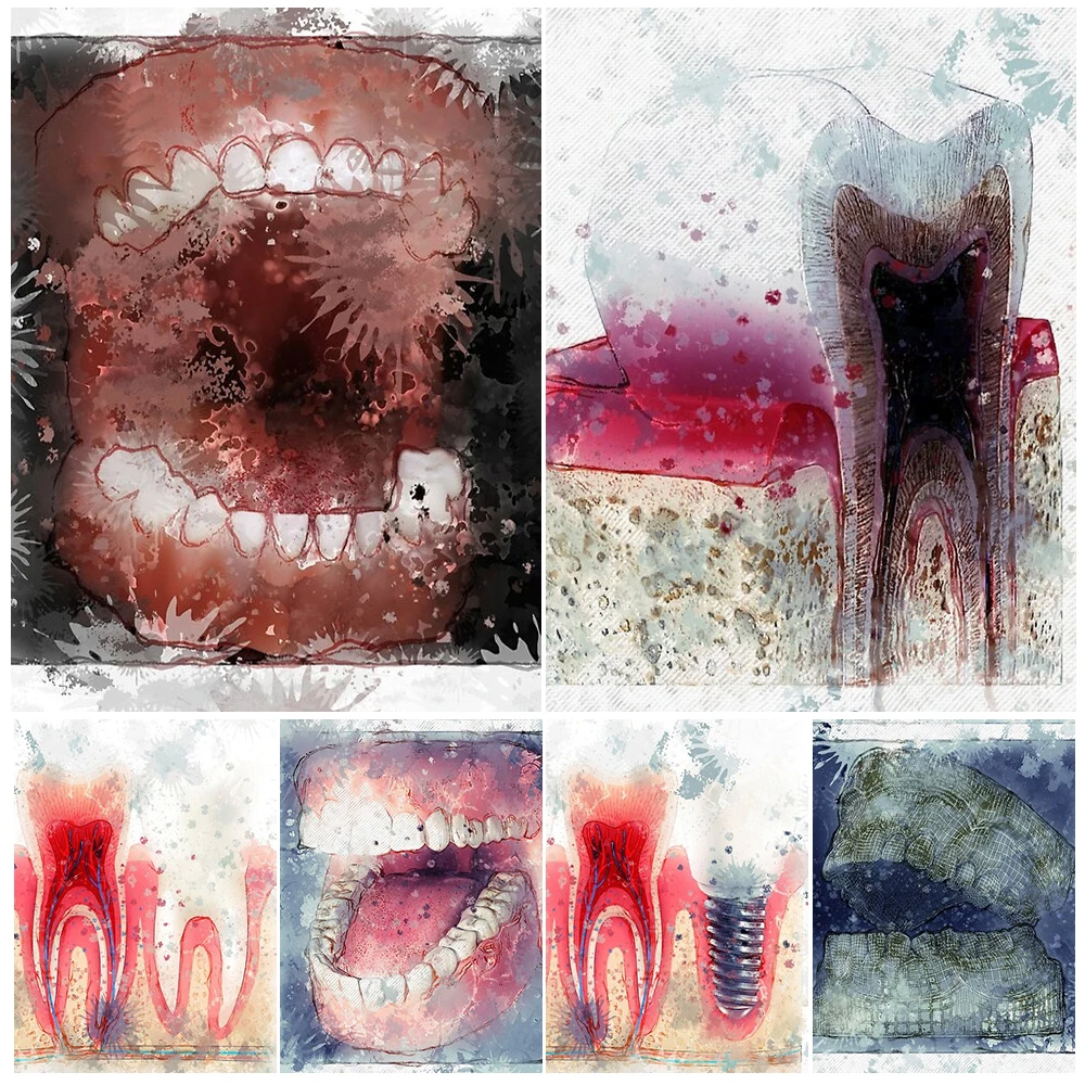 

Dentistry Clinic Teeth Oral Health Tooth Poster Wall Art Canvas Painting Home Decor Wall Pictures For Living Room Unframed