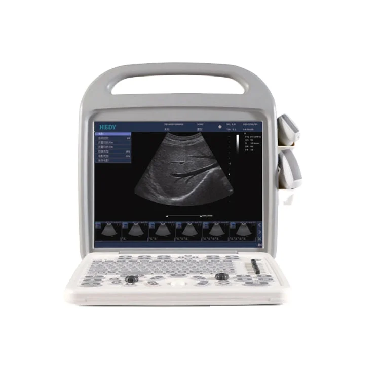 HEDY Portable Color Doppler 3D 4D Ultrasound machine for sale