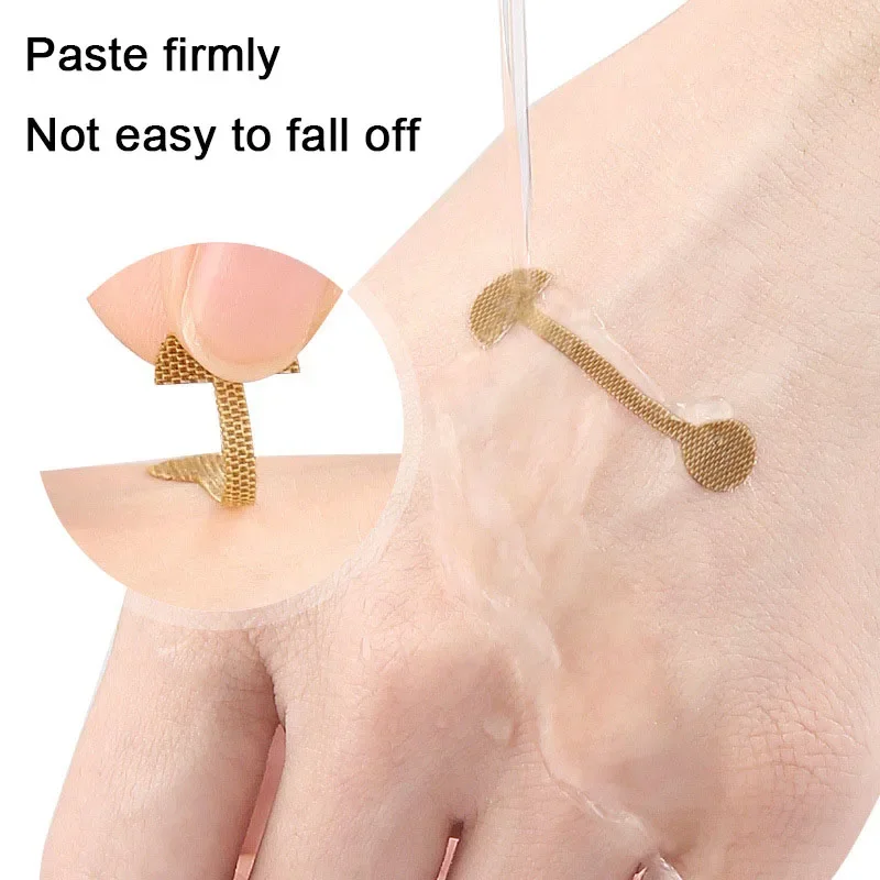 قطعتان من رقعة طرف الأنف الدمبل وتصحيح الأنف #5