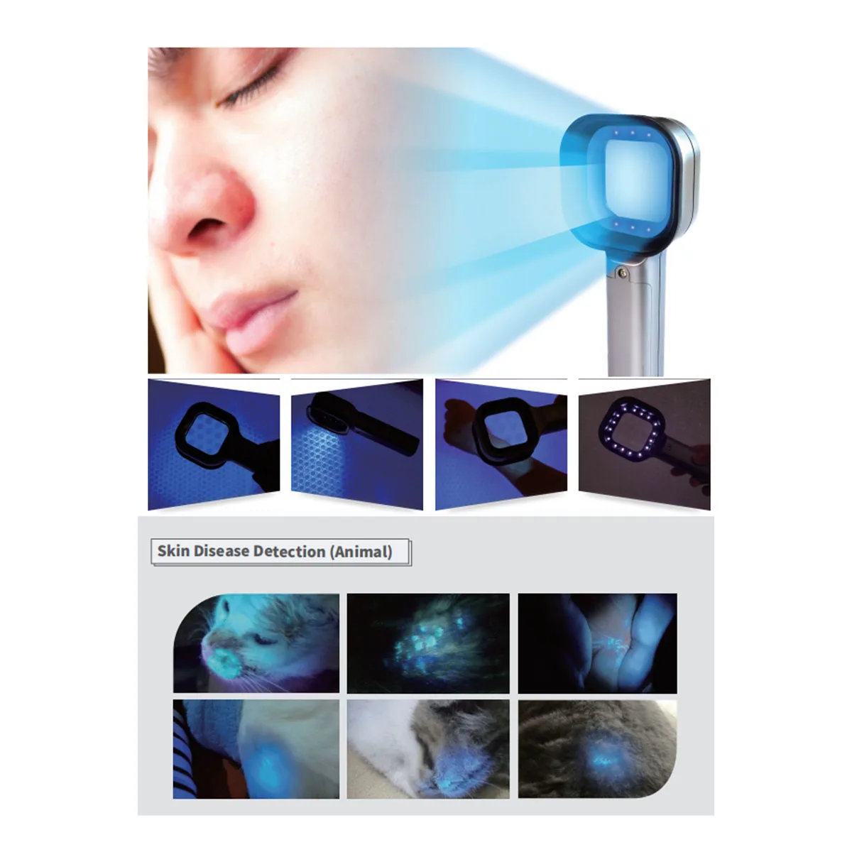 WHYY-Woods Lamp Skin Analyzer Portable Facial Salon Beauty Analyzer UV Woods Lamp For Skin Care