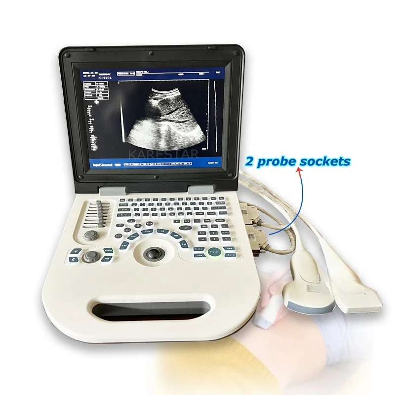 

usb ultrasound scanner portable echography 2D ultrasound diagnostic ultrasound machine