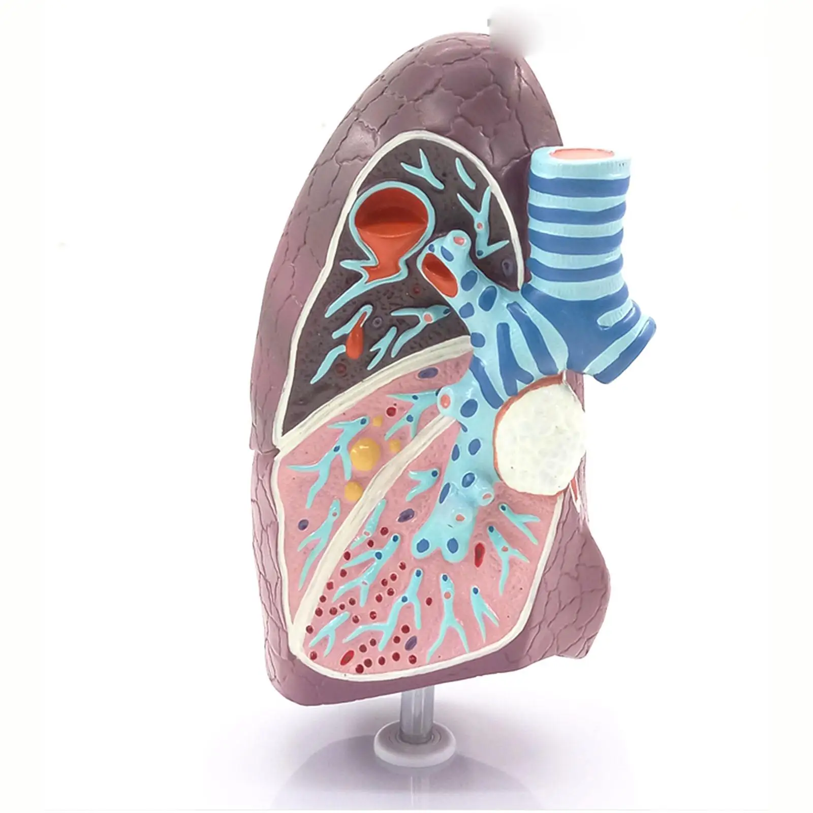 PVC Diseased Lung Medical Model Pulmonary Anatomy Respiratory System for Patient Education