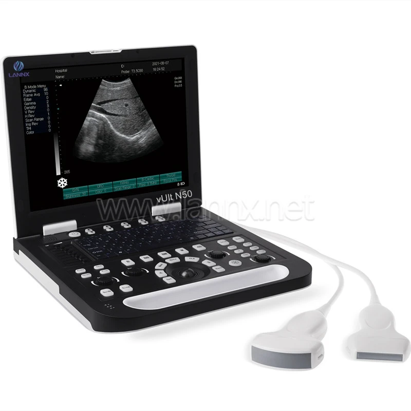 LANNX vUlt N50 Cheap medical animal pregnancy ultrasound scanner veterinary portable ultrasound machine Doppler Vet Ultrasonic