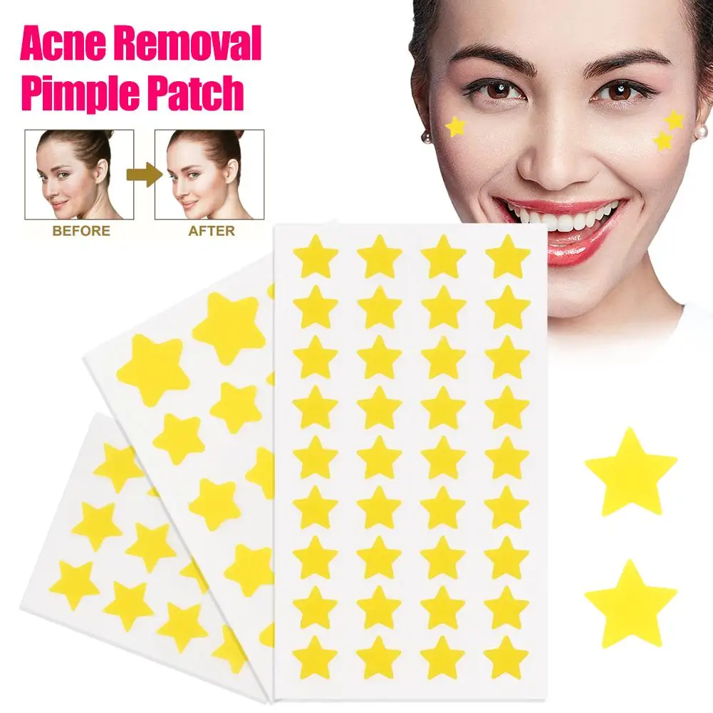 Remendo de espinhas em forma de estrela, adesivo hidrocolóide colorido de cura de espinhas, adesivo fofo de forte absorção, cuidados faciais