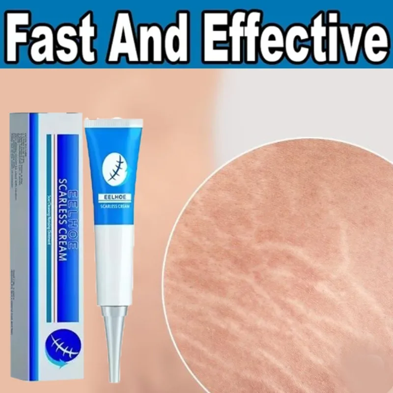 Stretch Mark Cream Anti-wrinkle Anti-aging Maternal Skin Repair Remove Pregnancy Eliminate Red White Old Stretch Marks skin Care