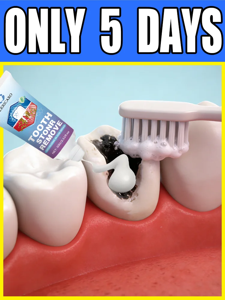 

The best-selling oral care tools of 2026 ᴄᴀɴ ᴘʀᴇᴄɪsᴇʟʏ ғɪʟʟ ᴄᴀᴠɪᴛɪᴇs ᴀɴᴅ ʀᴇᴘᴀɪʀ ᴛᴏᴏᴛʜ ᴅᴇᴄᴀʏ.