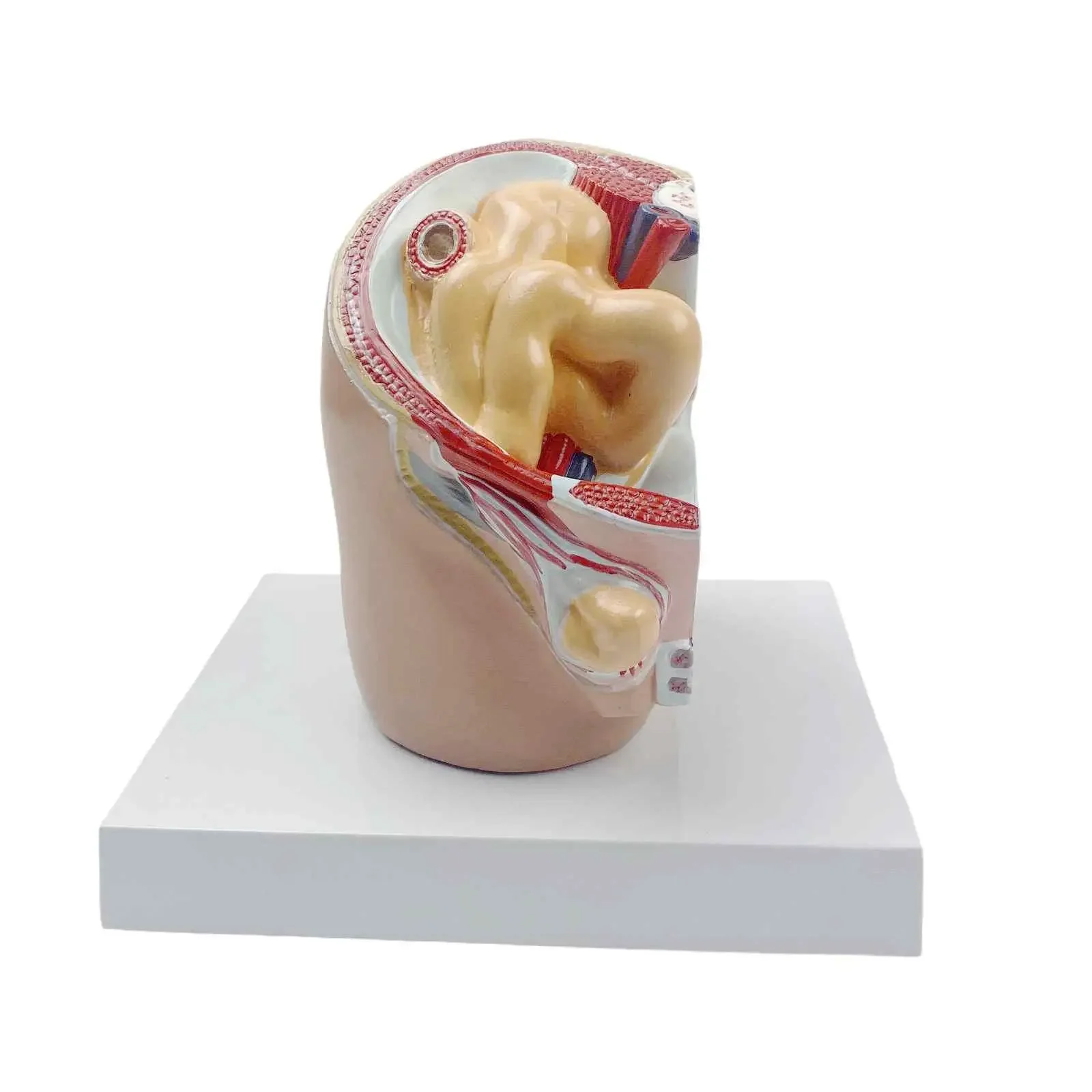 

Human Oblique Inguinal Hernia Pathological Skin Model Medical School