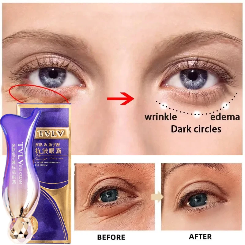 Magic Anti Wrinkle Eye Cream Lighten Fine Lines Anti Black Circles Serum Remove Eye Puffiness Anti-Aging Firming Eye Care 30g