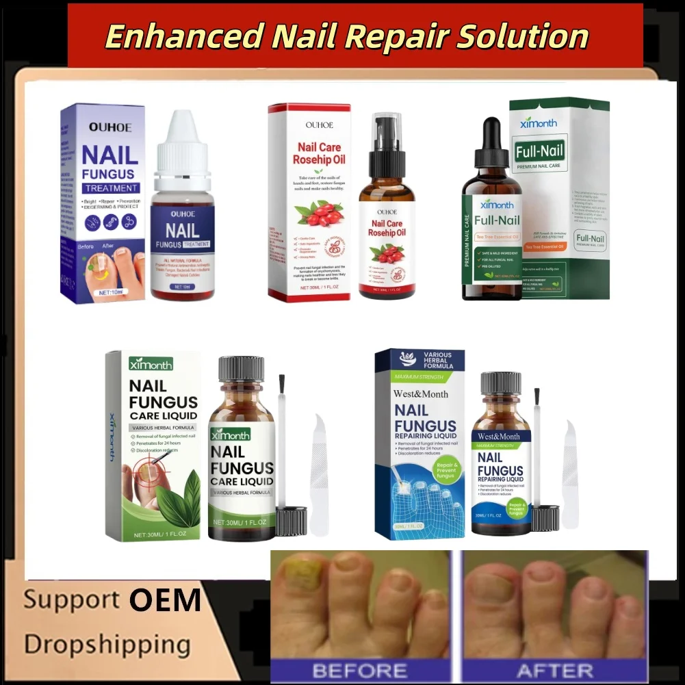 10/30ml Enhanced Nail Repair Solution Fangal Nail Renewal Gentle Care Tool for Nail Beauty Health Nail Repair Essence