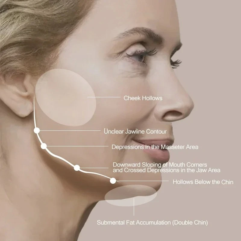 

Массажер против морщин для лифтинга глаз лица — профессиональное устройство против старения