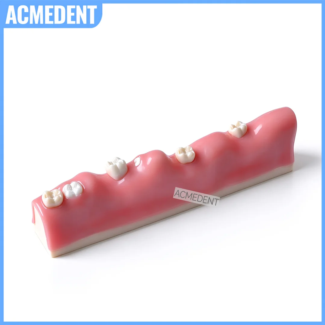 #38/48Dental Impacted Tooth Extraction Training Practice Wisdom Model Multiple Impaction Type For Gingival Incision Bone Cutting