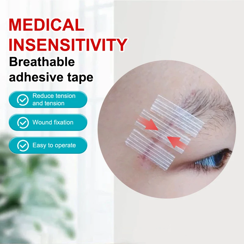 1 حقيبة شرائط إغلاق الجلد الجرح بعد الولادة إصلاح الجروح جراحة التجميل قطاع لاصق خياطة طبية شريط جراحي مجاني