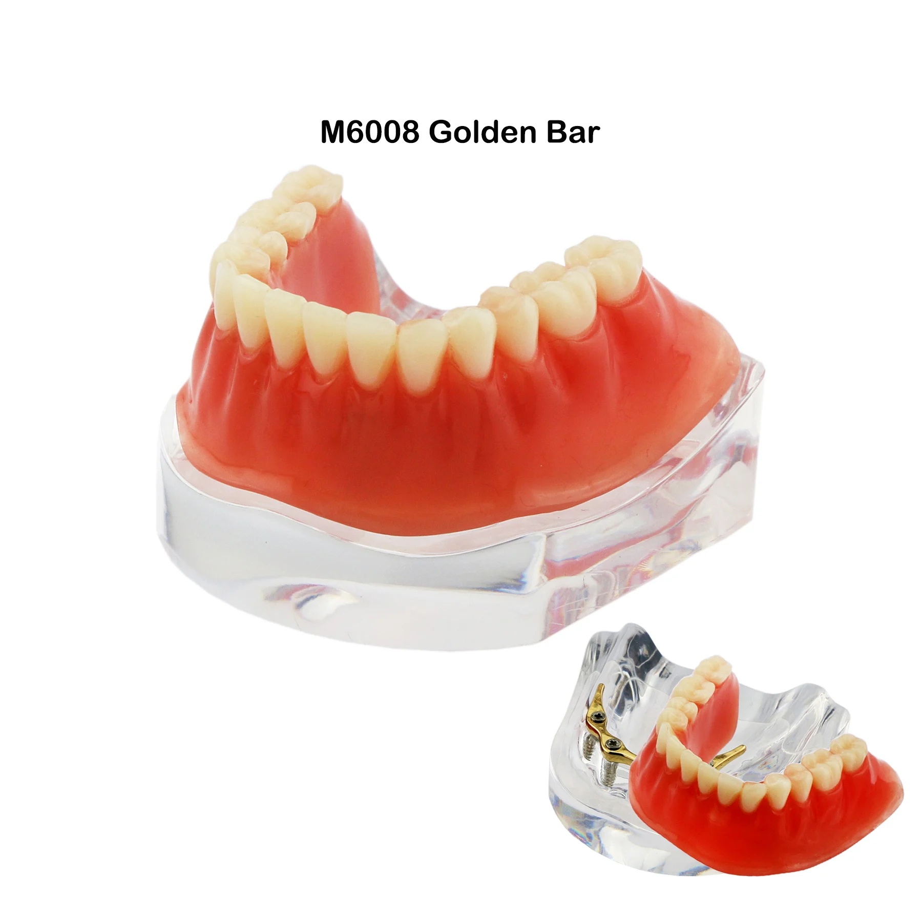 Dental Removable Overdenture Model zębów dolna szczęka 4 precyzyjne implanty Demo M6008 złota/srebrna belka