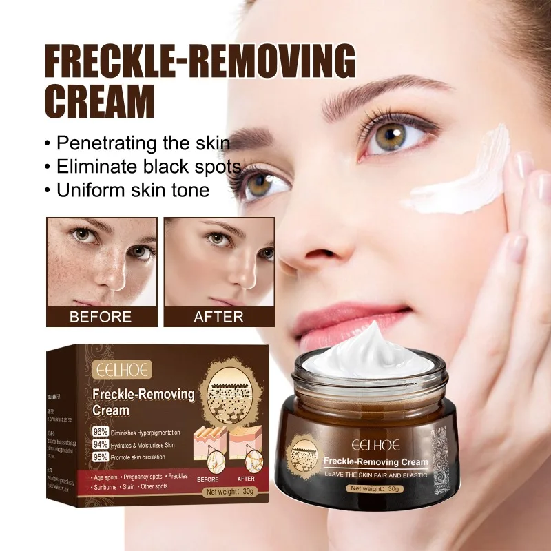 

Whitening Freckle Removing Cream Effectively Remove Melasma Dark Spot Acne Marks Lightening Melanin Hydrating Face Skin Care