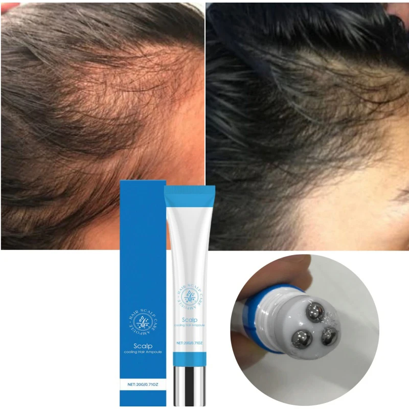 

Охлаждающая сыворотка для ухода за кожей головы, шариковая для роста волос, лечение против выпадения волос, питательная ампула для волос, укрепляет корни, массажер