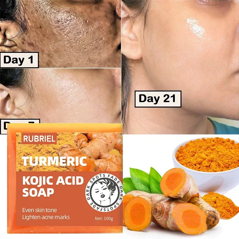 

Turmeric Kojic Soap Acid Whitening Chicken Skin Removal Dark Spot Removal Dead Skin Moisturize Brighten Body Care Sabonete