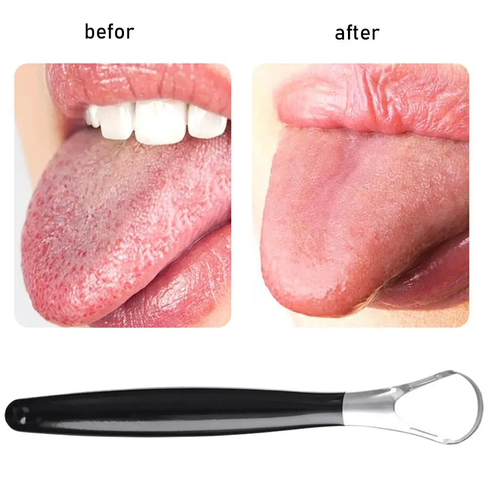 

Stainless Steel Tongue Scraper For Adults Eliminate Bad Breath And Keep Teeth Clean Bad Breath Removal Oral Care Tools W1I3